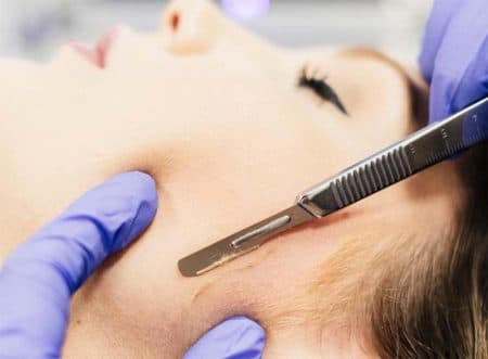 Dermaplaning facial