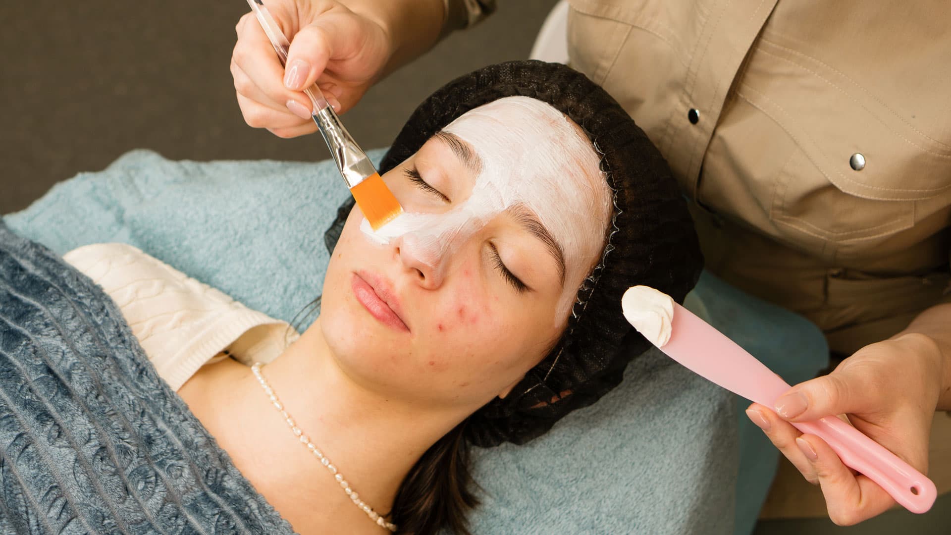 Acne facial treatment